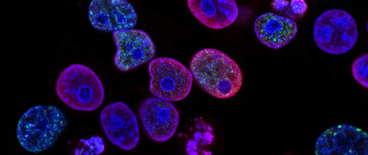 close up of something under the microscope
